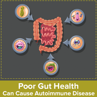 Poor Gut Health Can Cause Autoimmune Disease