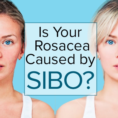 Is Your Rosacea Caused By Sibo