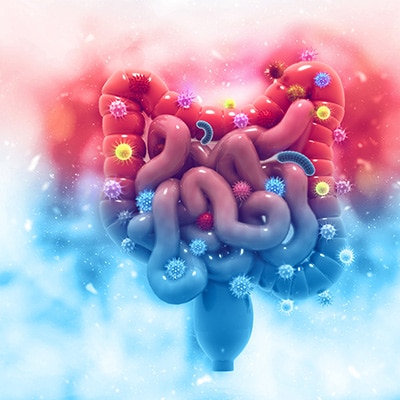 Protect Your Microbiome From Developing Colorectal Cancer Microbiome