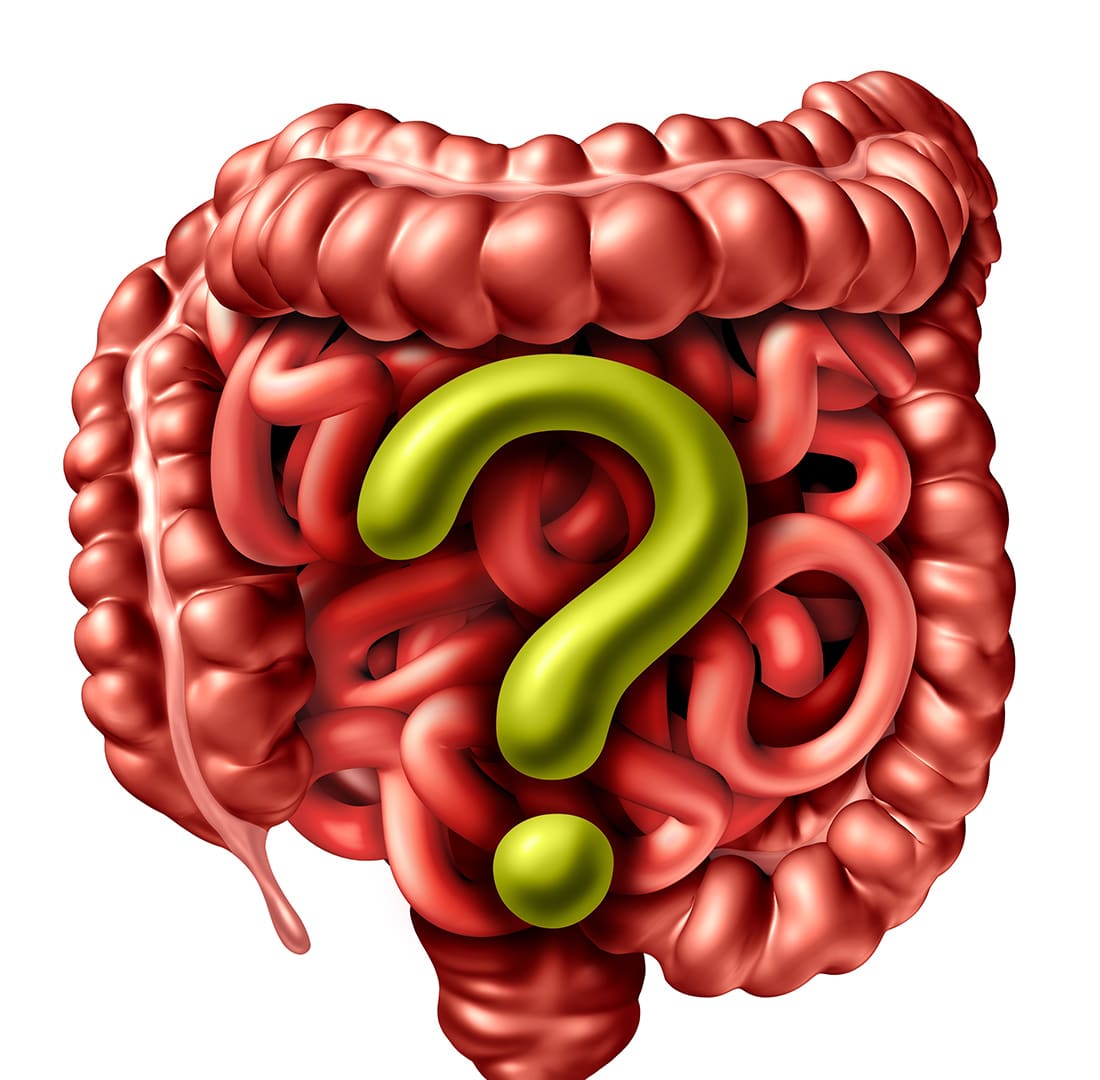 GI Tract with Large yellow question mark on it. having IBS problems