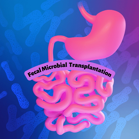 Fecal Microbial Transplantation