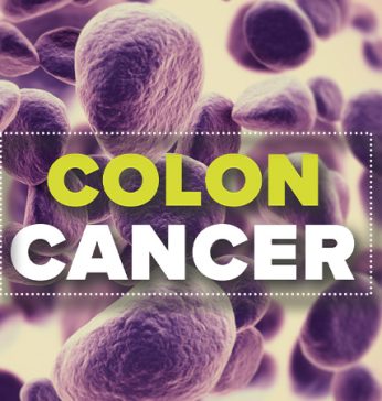 Colon Cancer