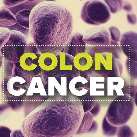 Colon Cancer