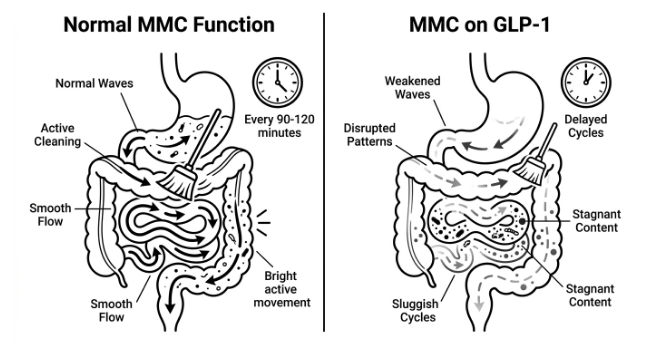 GLP-1 and Gut Health